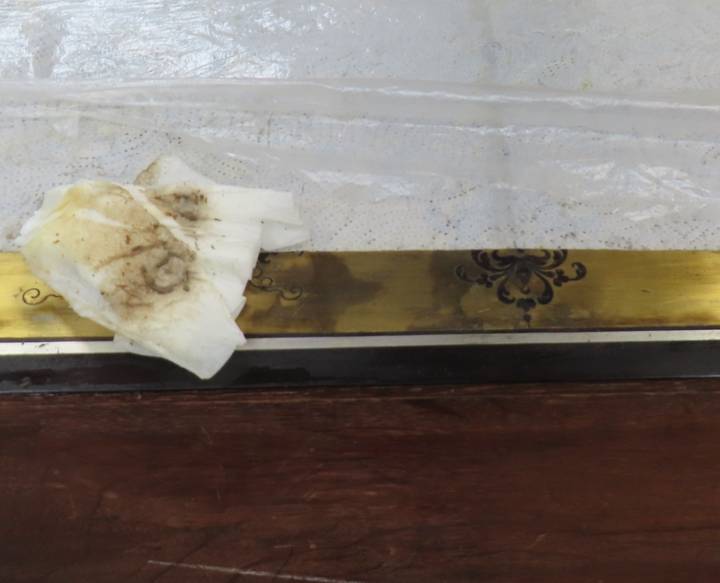 Detail of coffer (F412) during the removal of the IMS poultice.